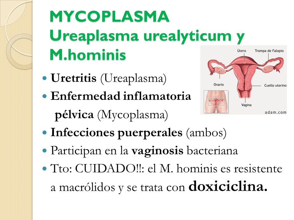 uretritis por micoplasmas